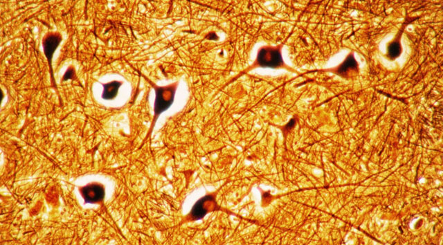 As células imunitárias falam a linguagem dos nervos